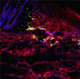 Nanotherapeutics and Deliver