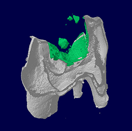 Tooth Repair and Dental Materials