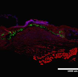 Animal Models and Clinical Studies